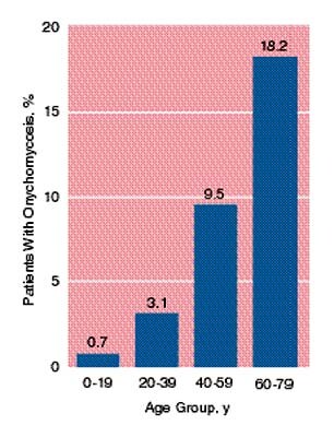foot fungus incidence