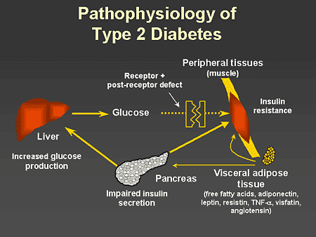Type 2 Diabetes Pathophysiology
