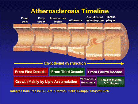 Cardiac Markers Timeline