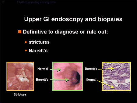 ibs endoscopy findings