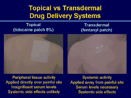 Topical vs Transdermal Drug Delivery Systems