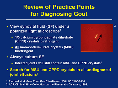 gout negative birefringence