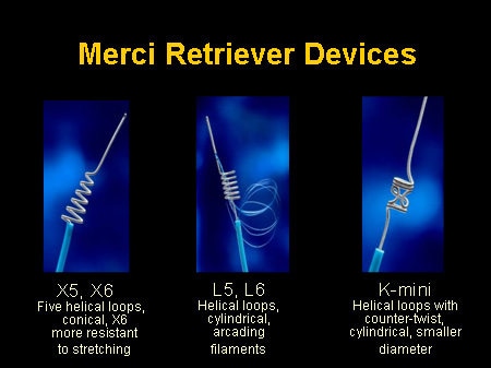 mini stroke reminiscence issues