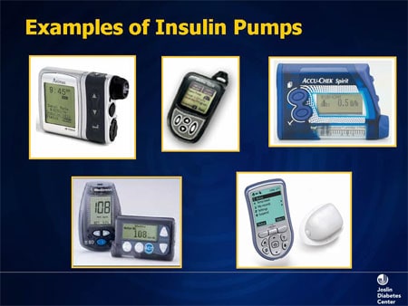 Insulin Pump Wearable Tech - Wearable Technology