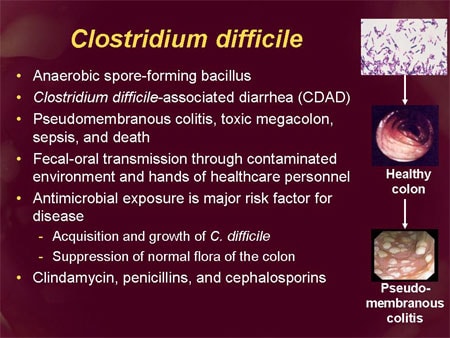 ObeSity may increase the risk of Clostridium difficile infection
