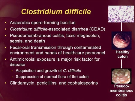 Low dose antibiotic treatment of C-difficile as effective as high dose in hospital setting