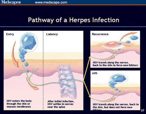 Transmission of HSV-2