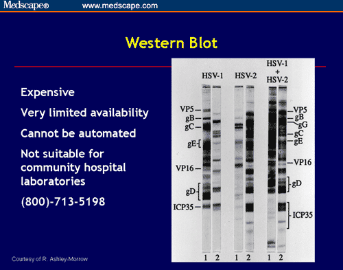 western blot test for herpes timing
