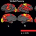 UHDRS cognitive scores.