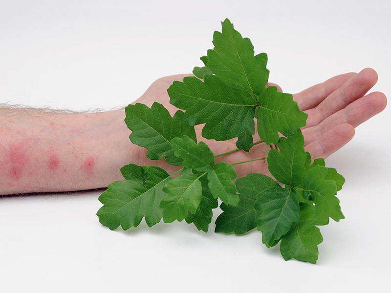 Prednisone Pediatric Dose Poison Ivy