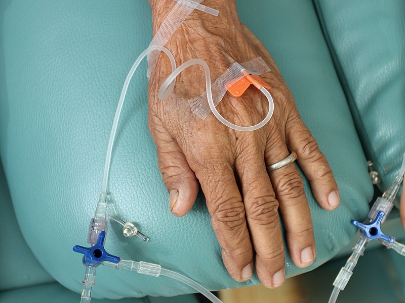 http://img.medscape.com/thumbnail_library/dt_150803_chemotherapy_elderly_senior_800x600.jpg