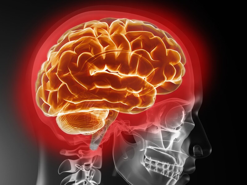 Brain Inflammation Linked To Schizophrenia Risk