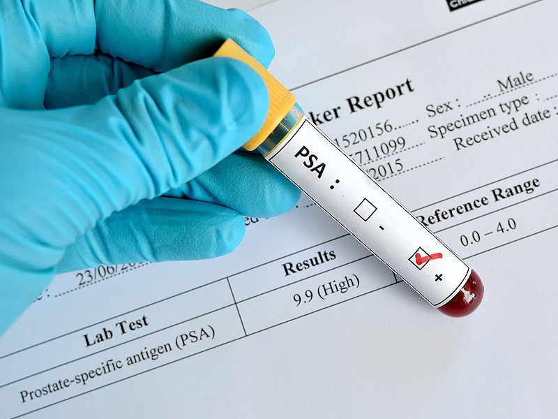 What does a PSA test result of 6 mean?