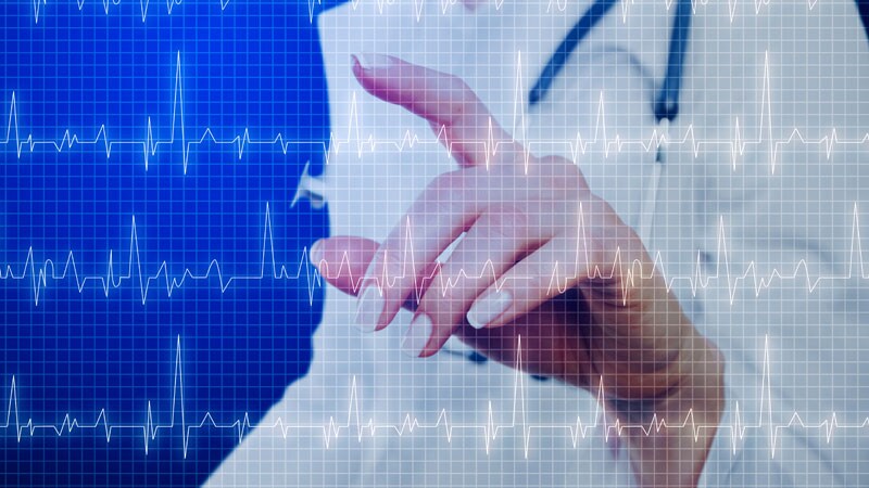 AI-Driven ECG for COVID-19 Rule-Out Has Mobile Potential 1 AI-Driven ECG for COVID-19 Rule-Out Has Mobile Potential