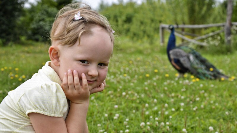 Pediatric Alopecia in the US Has Increased Twofold Since 2009 1 Pediatric Alopecia in the US Has Increased Twofold Since 2009