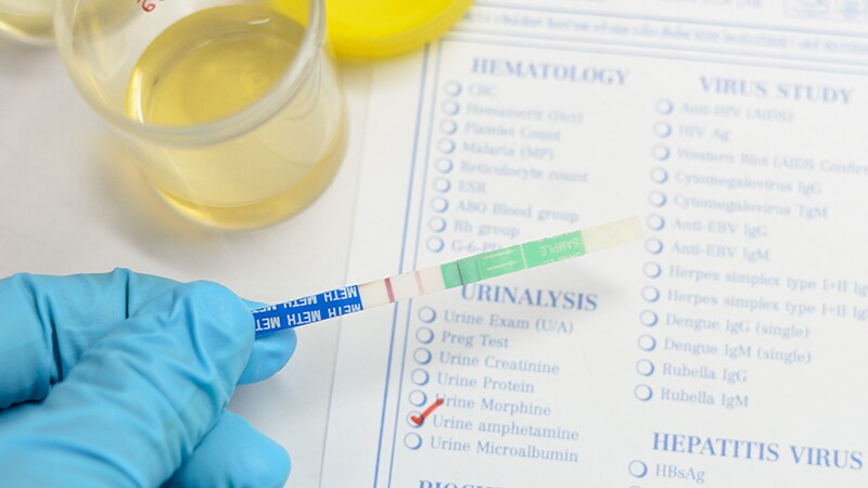 Rising Meth-related HF Admissions a 'Crisis,' Costly for Society 1 Rising Meth-related HF Admissions a 'Crisis,' Costly for Society