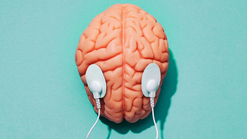 Long-term Benefit for DBS in Treating Parkinson's Motor Symptoms 1 Long-term Benefit for DBS in Treating Parkinson's Motor Symptoms