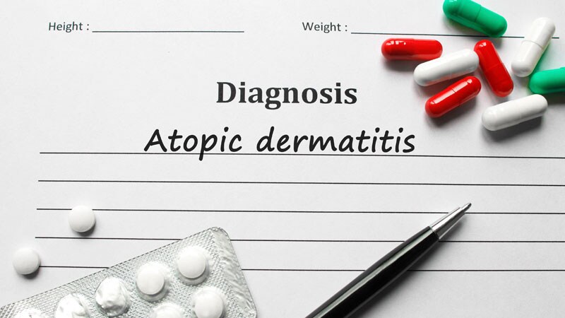 European Agency Supports Marketing of Abrocitinib for AD 1 European Agency Supports Marketing of Abrocitinib for AD