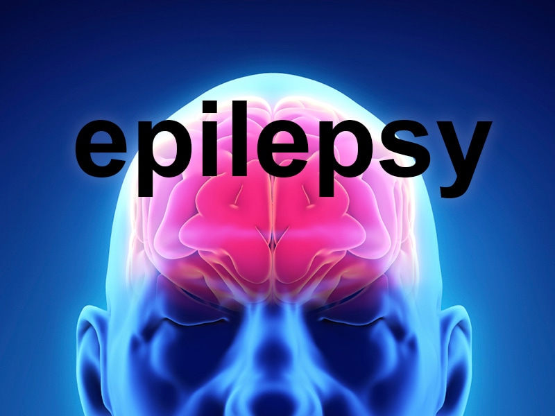 nocturnal epilepsy brain affected