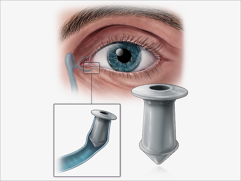 OCT Current and Future Applications