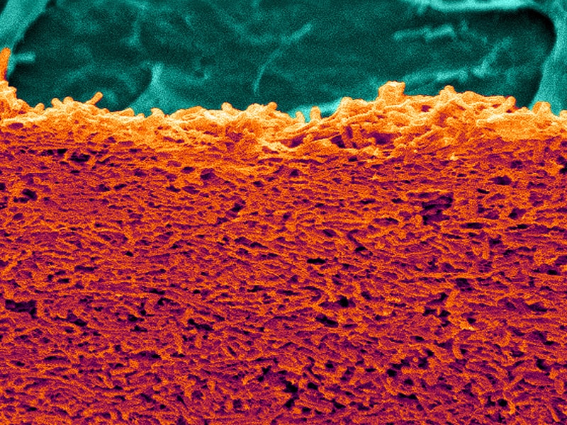 c difficile vagina group sex group sex gp