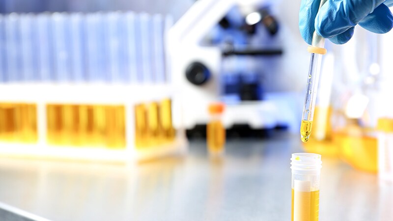 'New' Natriuretic Peptide Shows Unique Biomarker Potential 1 'New' Natriuretic Peptide Shows Unique Biomarker Potential