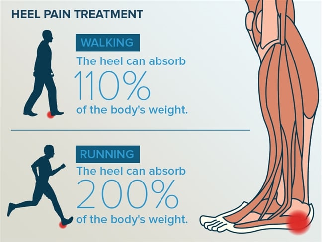 Prolozone therapy can eliminate heel pain - Second Nature Care 