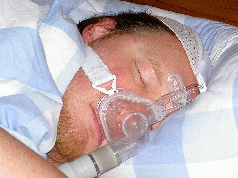 CPAP Benefits BP on Top of Weight Loss in Sleep Apnea