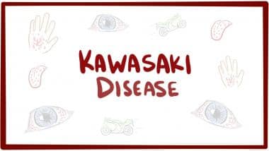 Infection maksud kawasaki