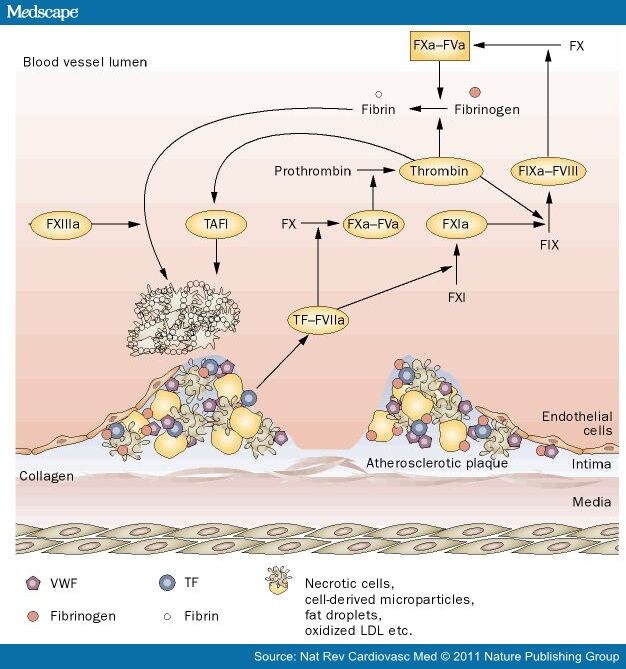 Arterial Thrombus Formation in Cardiovascular Disease