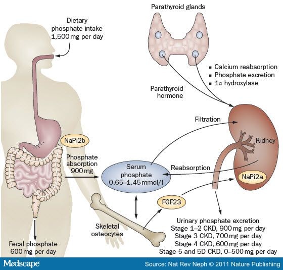 treatment hyperphosphatemia | kullee