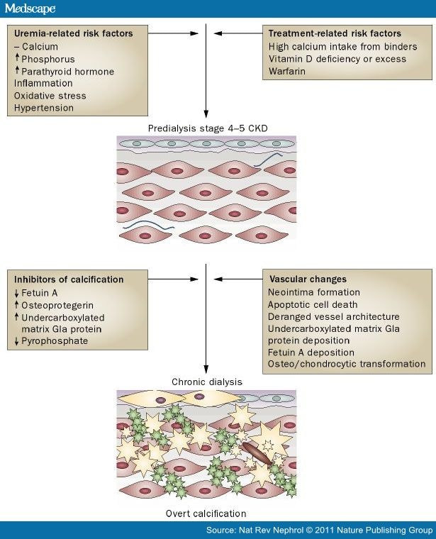 Cardiovascular Complications in Children With CKD