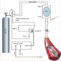 The Intra-aortic Balloon Pump in High-risk PCI