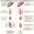 Hepatorenal Syndrome: A Cause of Kidney Failure in Cirrhosis