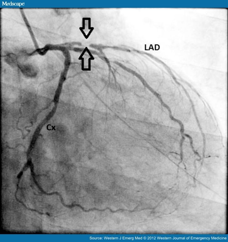 Red Flags in Electrocardiogram for Emergency Physicians