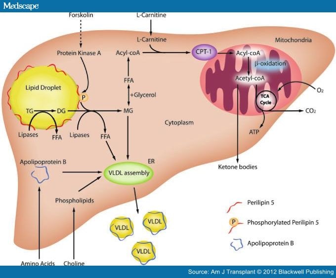 Alternative Approach to Enable Steatotic Liver Transplantation