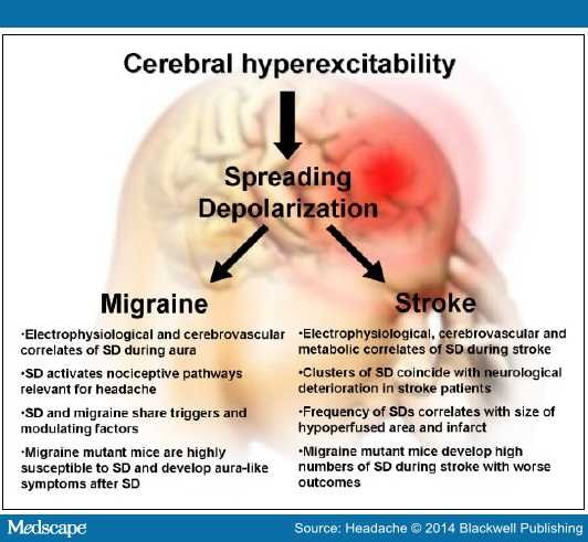 Spreading Depolarization May Link Migraine and Stroke