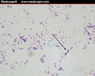 Lifestyles of Bacteria in Wounds: Presence of Biofilms?