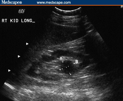 Private Practice Decisions: Case III: Right-Sided Abdominal Pain