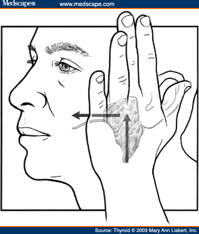 Radioactive Iodine and the Salivary Glands