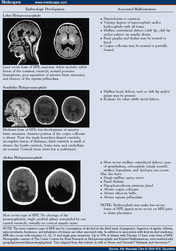 Recognizing the Clinical Features of Trisomy 13 Syndrome