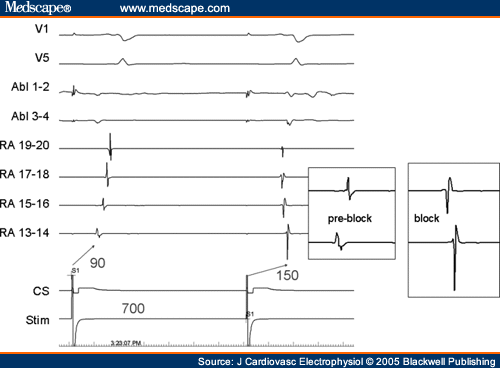 Recording Techniques for Clinical Electrophysiology