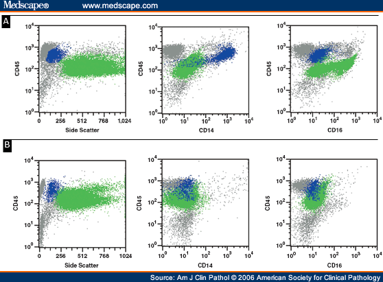 Flow Cytometric Detection of Paroxysmal Nocturnal Hemoglobinuria