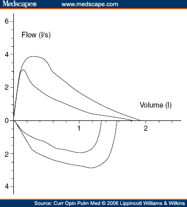 Spirometry in the Diagnosis of Asthma in Children: Spirometry for ...