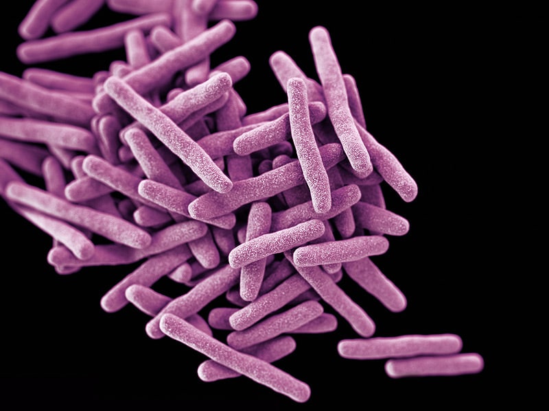 Deltyba Approved for MultidrugResistant TB in Europe