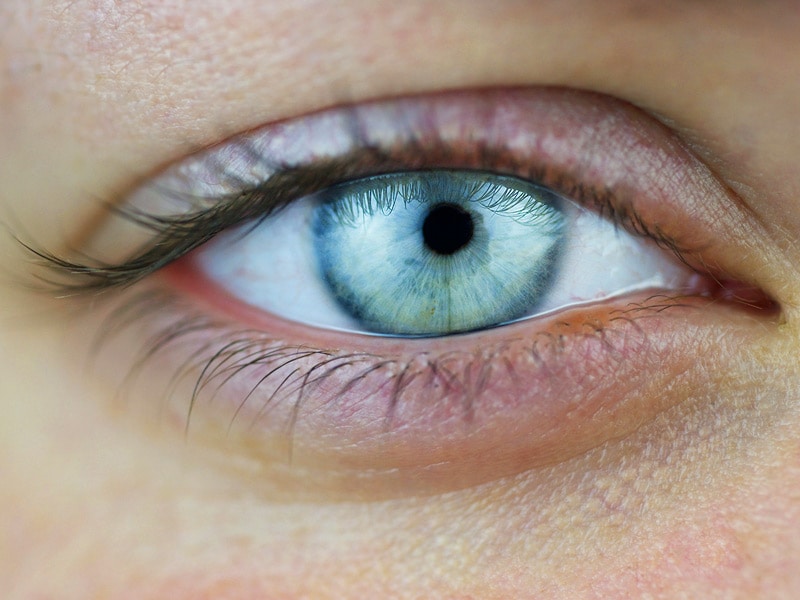 miotic pupil size