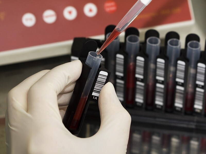 Blood Work Deutsch Blood Work Deutsch