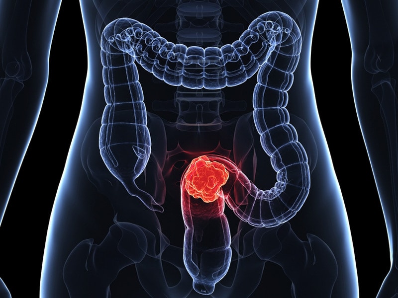 Appendix out. Метро пикадилли карта. Outlieders. Appendix out. Appendix out.