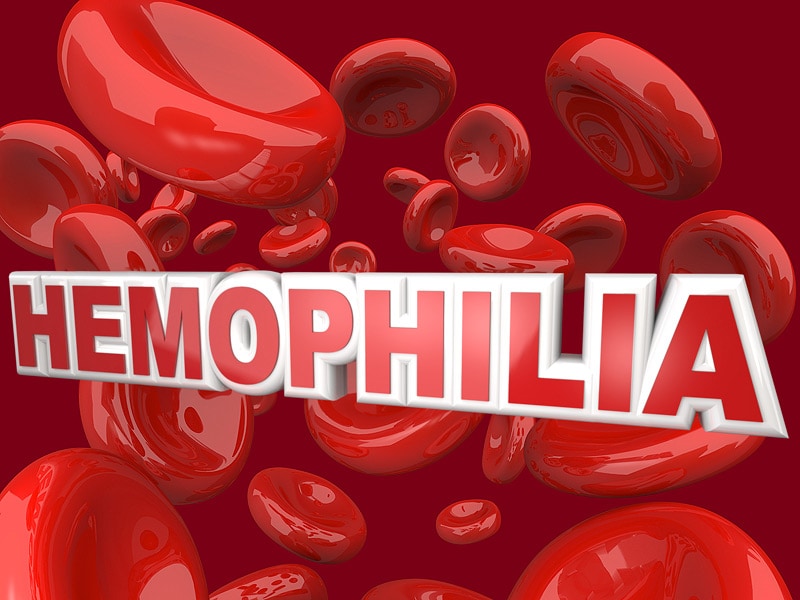 Chmp Backs Lonoctocog Alfa Afstyla For Hemophilia A