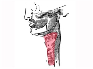 Electrical Stimulation Improves Swallowing After Stroke 